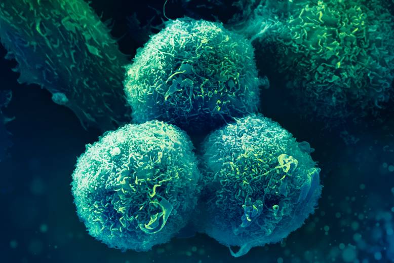 Oncology